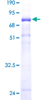 ERP44 Protein - 12.5% SDS-PAGE of human TXNDC4 stained with Coomassie Blue