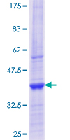 ERP44 Protein