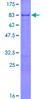 ERRFI1 / RALT Protein - 12.5% SDS-PAGE of human ERRFI1 stained with Coomassie Blue