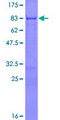 ERRFI1 / RALT Protein - 12.5% SDS-PAGE of human ERRFI1 stained with Coomassie Blue