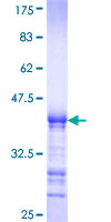 ERRFI1 / RALT Protein - 12.5% SDS-PAGE Stained with Coomassie Blue.