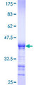 ERRFI1 / RALT Protein - 12.5% SDS-PAGE Stained with Coomassie Blue.