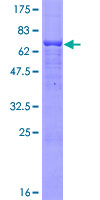 ESAM Protein - 12.5% SDS-PAGE of human ESAM stained with Coomassie Blue