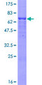 ESAM Protein - 12.5% SDS-PAGE of human ESAM stained with Coomassie Blue