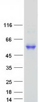 ESAM Protein - Purified recombinant protein ESAM was analyzed by SDS-PAGE gel and Coomassie Blue Staining