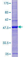 ESCO1 / ECO1 Protein - 12.5% SDS-PAGE of human ESCO1 stained with Coomassie Blue