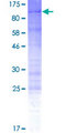 ESCO2 Protein - 12.5% SDS-PAGE of human ESCO2 stained with Coomassie Blue