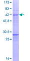 ESE3 / EHF Protein - 12.5% SDS-PAGE of human EHF stained with Coomassie Blue