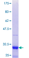 ESE3 / EHF Protein - 12.5% SDS-PAGE Stained with Coomassie Blue.