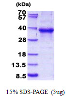 ESE3 / EHF Protein