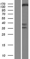 ESET / SETDB1 Protein - Western validation with an anti-DDK antibody * L: Control HEK293 lysate R: Over-expression lysate