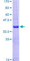 ESET / SETDB1 Protein - 12.5% SDS-PAGE Stained with Coomassie Blue.