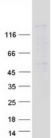 ESET / SETDB1 Protein - Purified recombinant protein SETDB1 was analyzed by SDS-PAGE gel and Coomassie Blue Staining