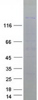 ESET / SETDB1 Protein - Purified recombinant protein SETDB1 was analyzed by SDS-PAGE gel and Coomassie Blue Staining