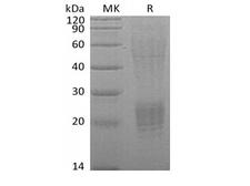ESM1 / Endocan Protein - Recombinant Human Endocan/ESM-1 (C-6His)