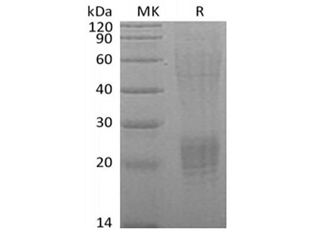 ESM1 / Endocan Protein - Recombinant Human Endocan/ESM-1 (C-6His)