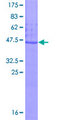 ESM1 / Endocan Protein - 12.5% SDS-PAGE of human ESM1 stained with Coomassie Blue