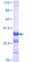 ESM1 / Endocan Protein - 12.5% SDS-PAGE Stained with Coomassie Blue.