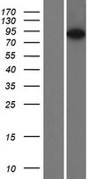 ESPN / Espin Protein - Western validation with an anti-DDK antibody * L: Control HEK293 lysate R: Over-expression lysate