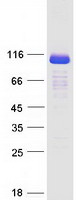 ESPN / Espin Protein - Purified recombinant protein ESPN was analyzed by SDS-PAGE gel and Coomassie Blue Staining