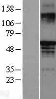 ESR2 / ER Beta Protein - Western validation with an anti-DDK antibody * L: Control HEK293 lysate R: Over-expression lysate