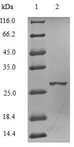 ESR2 / ER Beta Protein - (Tris-Glycine gel) Discontinuous SDS-PAGE (reduced) with 5% enrichment gel and 15% separation gel.