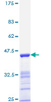 ESR2 / ER Beta Protein - 12.5% SDS-PAGE Stained with Coomassie Blue.