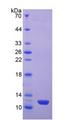 ESR2 / ER Beta Protein - Recombinant Estrogen Receptor Beta By SDS-PAGE