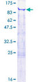 ESRP2 / RBM35B Protein - 12.5% SDS-PAGE of human RBM35B stained with Coomassie Blue