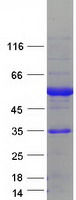 ESRRA / ERR Alpha Protein - Purified recombinant protein ESRRA was analyzed by SDS-PAGE gel and Coomassie Blue Staining