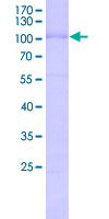 ESRRB / ERR Beta Protein - 12.5% SDS-PAGE Stained with Coomassie Blue