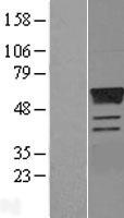 ESRRG / ERR Gamma Protein - Western validation with an anti-DDK antibody * L: Control HEK293 lysate R: Over-expression lysate