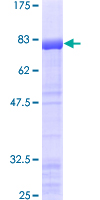 ESRRG / ERR Gamma Protein - 12.5% SDS-PAGE of human ESRRG stained with Coomassie Blue