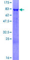 ESRRG / ERR Gamma Protein - 12.5% SDS-PAGE of human ESRRG stained with Coomassie Blue