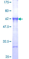 Esterase D / ESD Protein - 12.5% SDS-PAGE of human ESD stained with Coomassie Blue