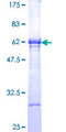 Esterase D / ESD Protein - 12.5% SDS-PAGE of human ESD stained with Coomassie Blue