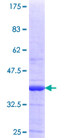 Esterase D / ESD Protein - 12.5% SDS-PAGE Stained with Coomassie Blue.