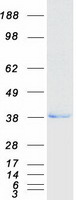 Esterase D / ESD Protein - Purified recombinant protein ESD was analyzed by SDS-PAGE gel and Coomassie Blue Staining