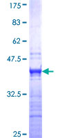 ESX1 Protein - 12.5% SDS-PAGE Stained with Coomassie Blue.