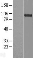 ESYT2 / E-Syt2 Protein - Western validation with an anti-DDK antibody * L: Control HEK293 lysate R: Over-expression lysate