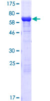 ETF1 / ERF1 Protein - 12.5% SDS-PAGE of human ETF1 stained with Coomassie Blue