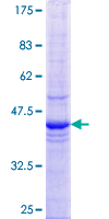 ETF1 / ERF1 Protein - 12.5% SDS-PAGE Stained with Coomassie Blue.