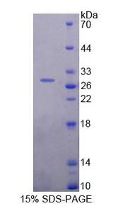 ETF1 / ERF1 Protein - Recombinant Eukaryotic Translation Termination Factor 1 (ETF1) by SDS-PAGE