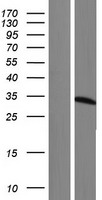 ETFA Protein - Western validation with an anti-DDK antibody * L: Control HEK293 lysate R: Over-expression lysate
