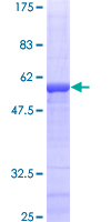 ETFA Protein - 12.5% SDS-PAGE of human ETFA stained with Coomassie Blue