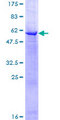 ETFA Protein - 12.5% SDS-PAGE of human ETFA stained with Coomassie Blue