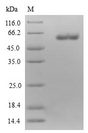ETFA Protein - (Tris-Glycine gel) Discontinuous SDS-PAGE (reduced) with 5% enrichment gel and 15% separation gel.
