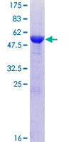 ETFB Protein - 12.5% SDS-PAGE of human ETFB stained with Coomassie Blue