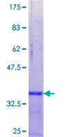 ETFB Protein - 12.5% SDS-PAGE Stained with Coomassie Blue.