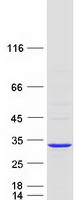 ETFB Protein - Purified recombinant protein ETFB was analyzed by SDS-PAGE gel and Coomassie Blue Staining